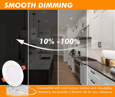 Ultra-Thin LED Recessed Light with Junction Box, 4 Inch, 5CCT, 120V 10W, White, 6 PCs