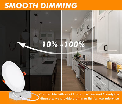 Ultra-Thin LED Recessed Light with Junction Box, 6 Inch, 5CCT, 120V 15W, White, 6 PCs